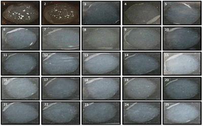 A rapid direct-differential agglutination assay for Brucella detection using antibodies conjugated with functionalized gold nanoparticles